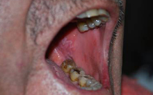 Dental Diagnostic treatment in Safdarjung Enclave