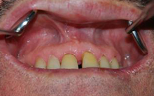 Dental Diagnostic treatment in Yusuf Sarai